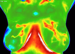 Thermography is a Tool to Check for Breast Health